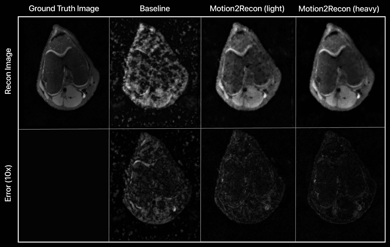 Motion2Recon: Motion-robust semi-supervised MRI reconstruction
