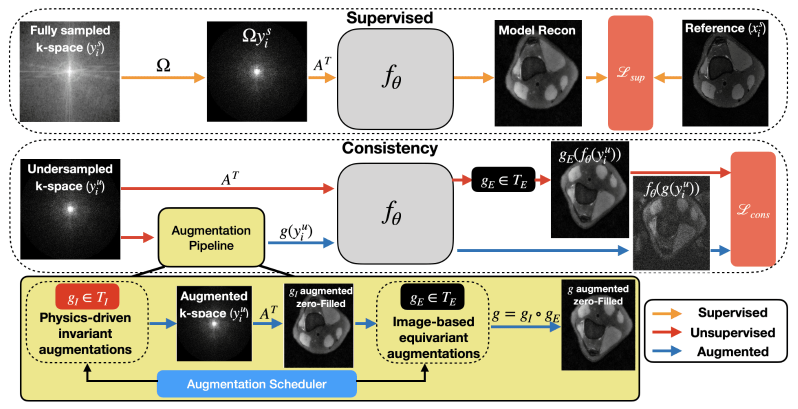VORTEX: Physics-driven data augmentations for MRI reconstruction